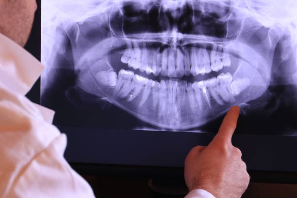Best Tooth Pain Emergency Relief  in Glenrock, WY