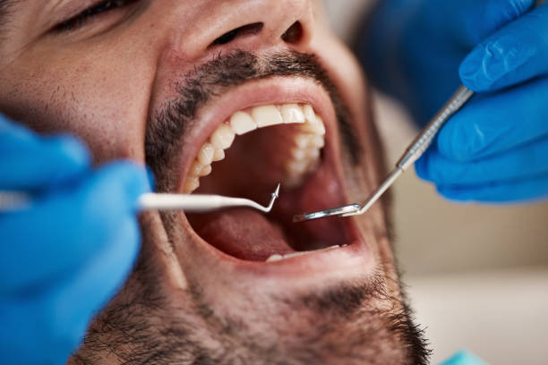 Best Urgent Tooth Repair  in Glenrock, WY