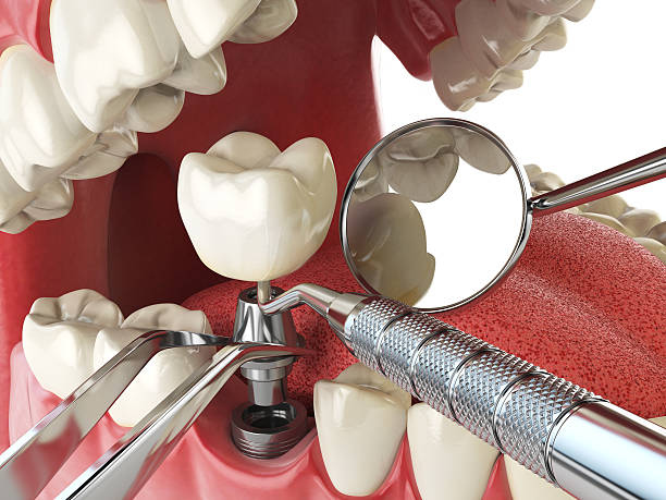 Best Emergency Gum Pain Relief  in Glenrock, WY